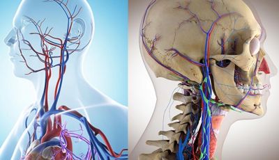 Neuronavegação acoplada a angiografia – Tecnologia em MAV
